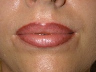 Lip-Tattoo